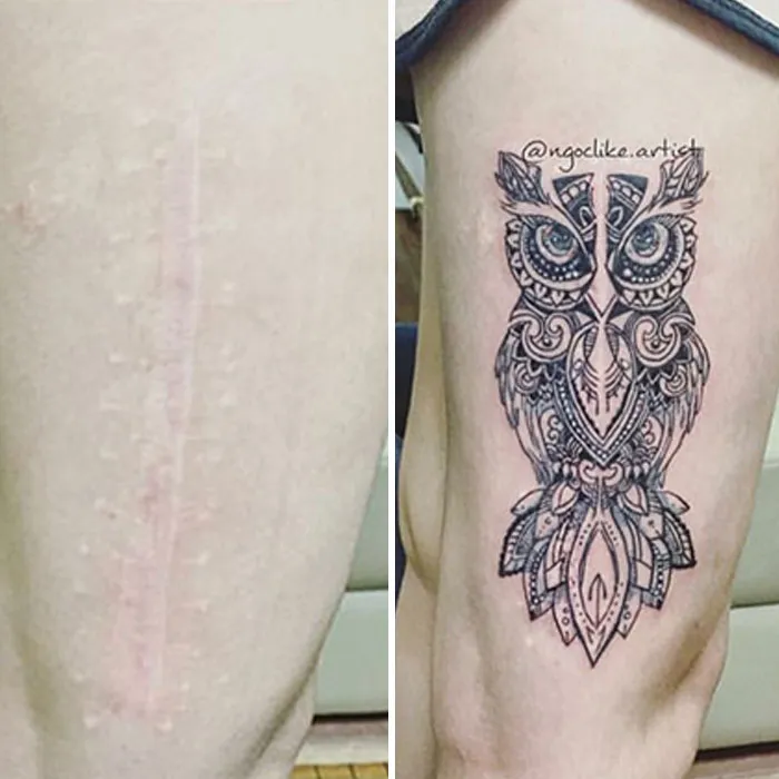 30 Times People Asked To Cover Up Their Scars, And This Tattoo Artist Nailed It