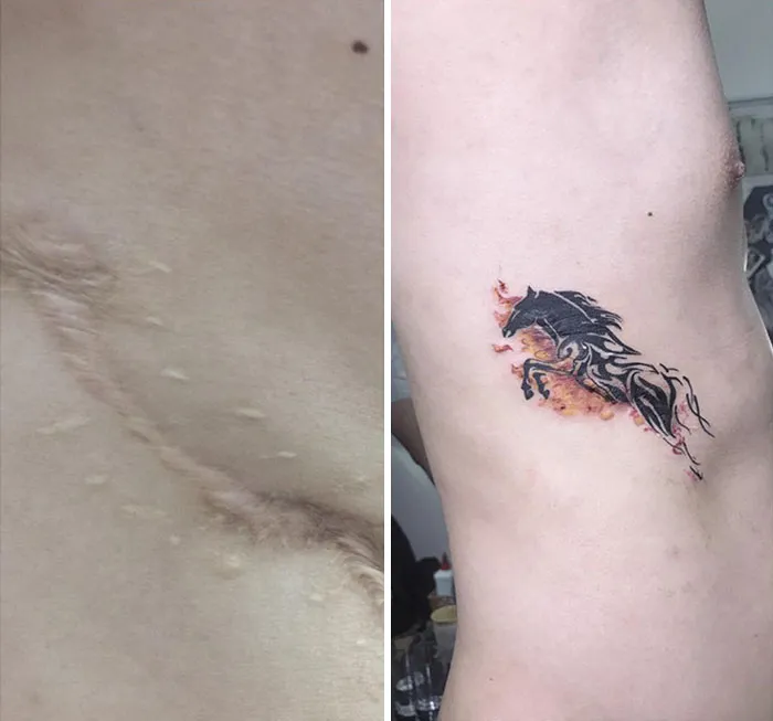 30 Times People Asked To Cover Up Their Scars, And This Tattoo Artist Nailed It