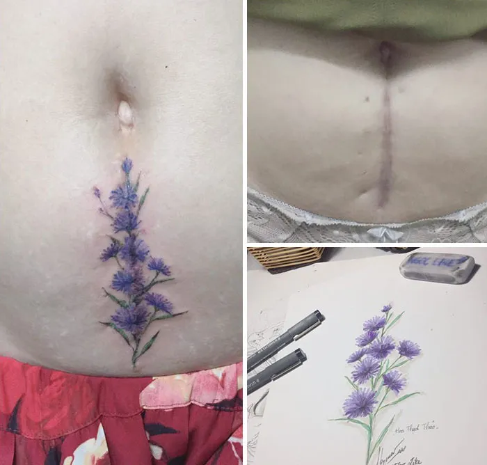 30 Times People Asked To Cover Up Their Scars, And This Tattoo Artist Nailed It