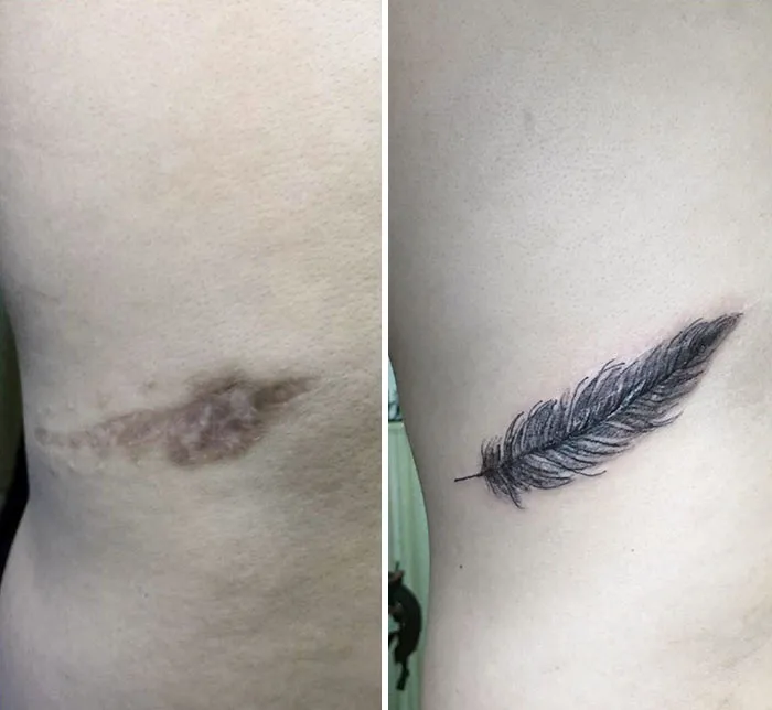 30 Times People Asked To Cover Up Their Scars, And This Tattoo Artist Nailed It