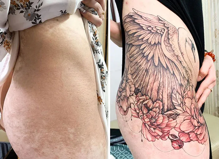 30 Times People Asked To Cover Up Their Scars, And This Tattoo Artist Nailed It