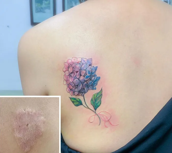 30 Times People Asked To Cover Up Their Scars, And This Tattoo Artist Nailed It