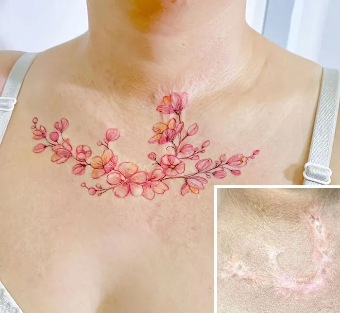30 Times People Asked To Cover Up Their Scars, And This Tattoo Artist Nailed It