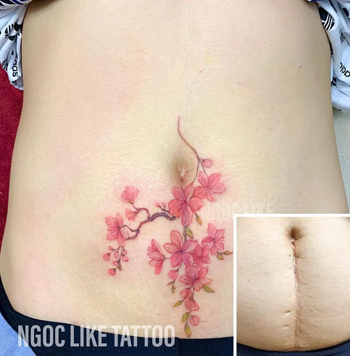 30 Times People Asked To Cover Up Their Scars, And This Tattoo Artist Nailed It