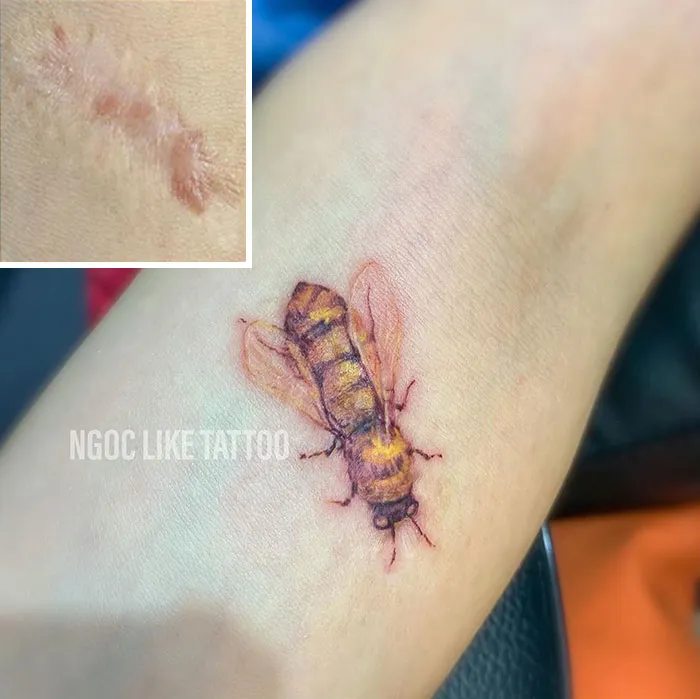 30 Times People Asked To Cover Up Their Scars, And This Tattoo Artist Nailed It
