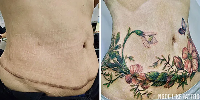 30 Times People Asked To Cover Up Their Scars, And This Tattoo Artist Nailed It