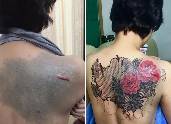 30 Times People Asked To Cover Up Their Scars, And This Tattoo Artist Nailed It