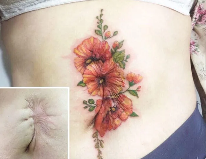 30 Times People Asked To Cover Up Their Scars, And This Tattoo Artist Nailed It