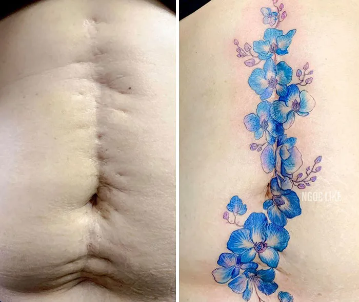 30 Times People Asked To Cover Up Their Scars, And This Tattoo Artist Nailed It
