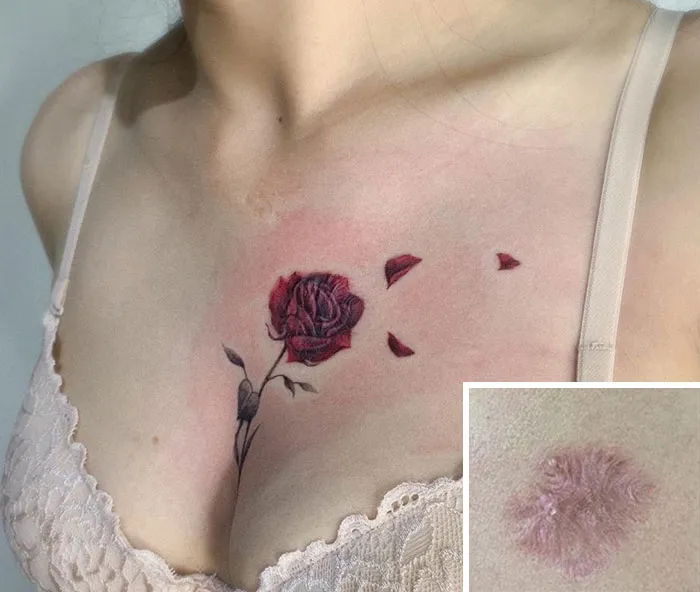 30 Times People Asked To Cover Up Their Scars, And This Tattoo Artist Nailed It