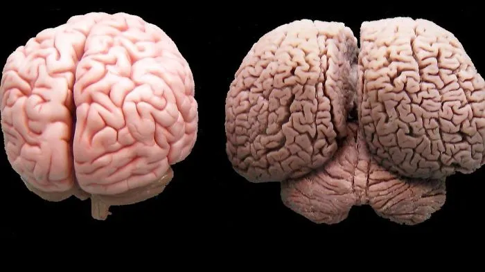 Cerebro humano y cerebro de delfín