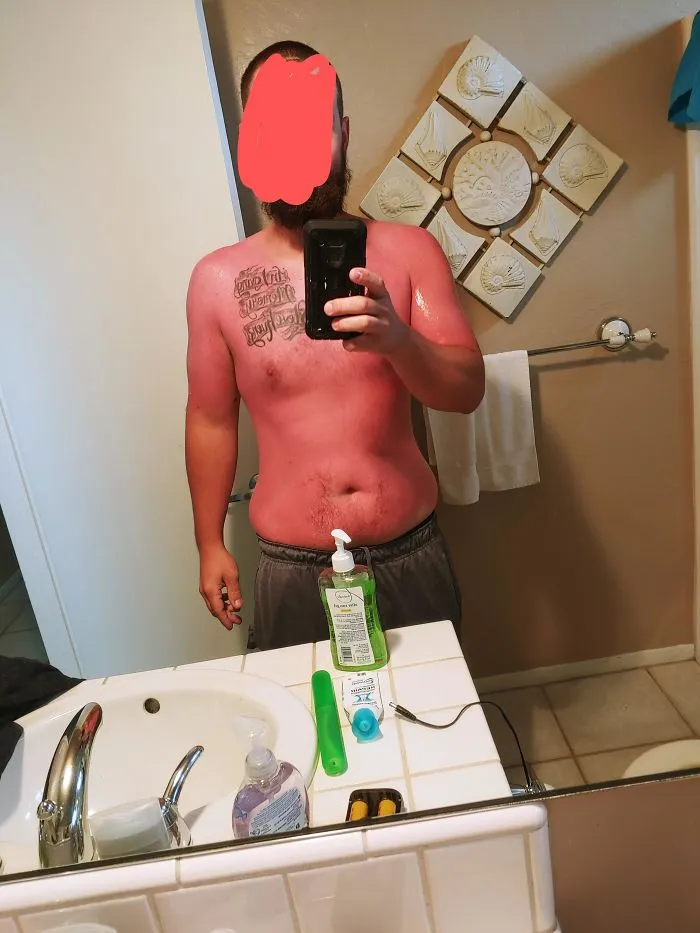 Cuando eres de Arizona y piensas que 21 grados en la playa en California no requiere crema solar
