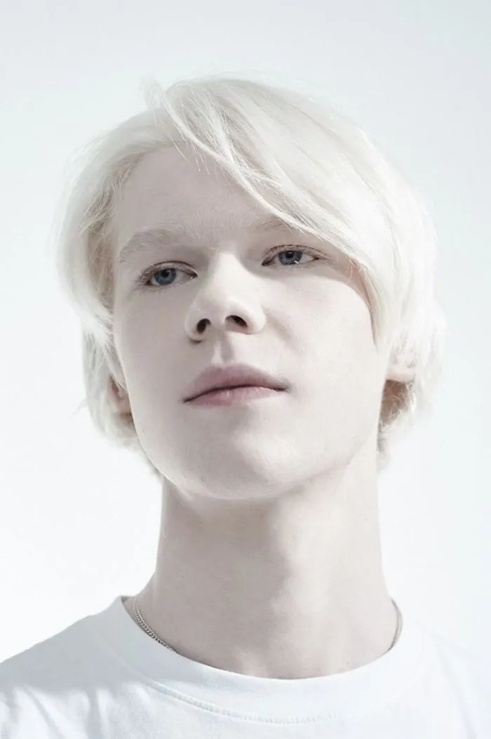 Ilya, An Albino