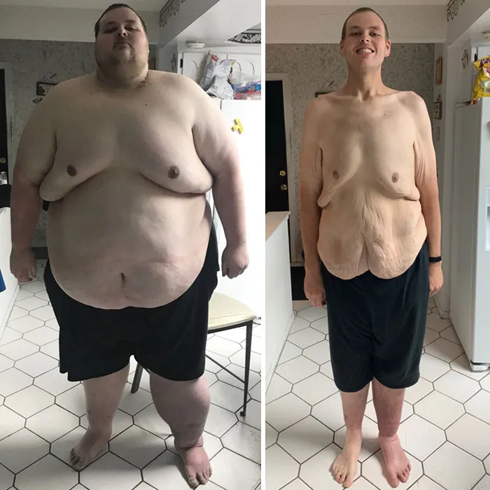 Celebrated 2 Years On My Weightloss Journey Yesterday! Lost My Weight Thru Dieting (Calorie Counting) A Lot Of Swimming, Walking And Some Bicycling (No Surgery) Anything Is Possible!