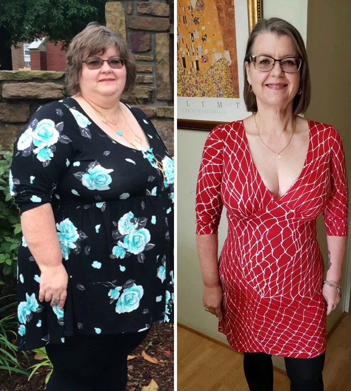 Lost 170 Lbs In 2 Years 3 Months