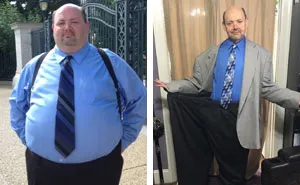 50 Times People Surprised Everyone By Losing So Much Weight They Looked Like A Different Person (New Pics)