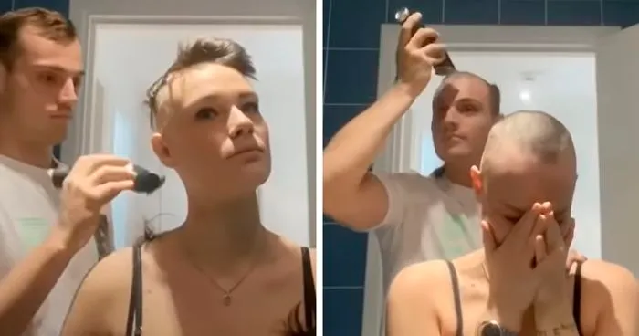 Boyfriend Shaves Girlfriend's Head Due To Alopecia Only To Shave His Own Immediately
