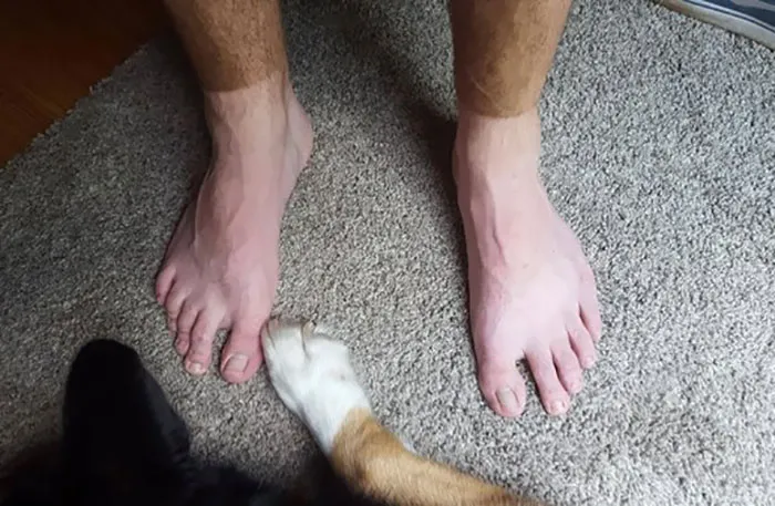 It's More Than Just A Tan, Buddy