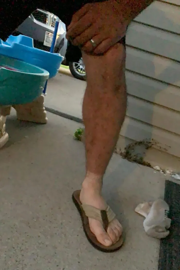 My Husband's First Time Wearing Sandals Since Starting His New Asphalt Job