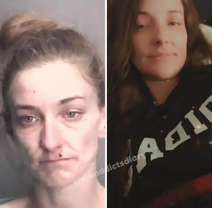 ‘The Addict’s Diary’ Showcases Before & After Transformations Of People Who Quit Drugs (30 New Stories)