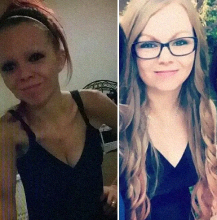 ‘The Addict’s Diary’ Showcases Before & After Transformations Of People Who Quit Drugs (30 New Stories)