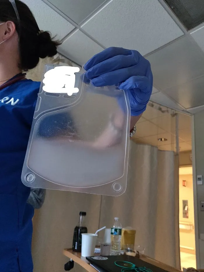 Aquí están mis glóbulos blancos extirpados y modificados genéticamente, a punto de ser colocados de nuevo para, con suerte, curar mi cáncer