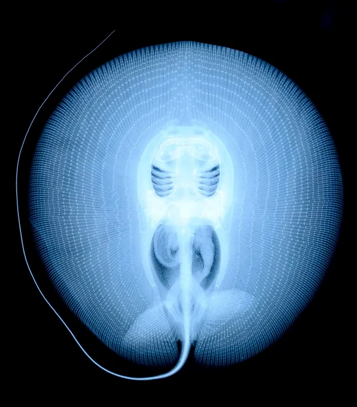 X-Ray Of A Stingray