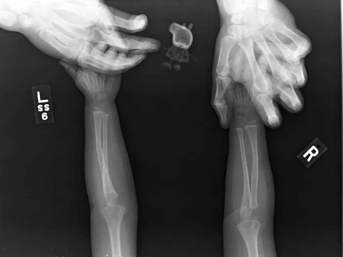 Daughter Demanded Peppa Pig Get X-Ray With Her