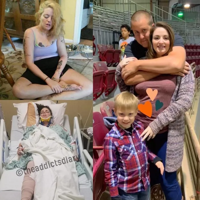 ‘The Addict’s Diary’ Showcases Before & After Transformations Of People Who Quit Drugs (30 New Stories)
