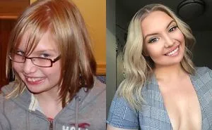 People Who Used To Be "Ugly Ducklings" Share Their Transformations, And We Can Barely Recognize Them