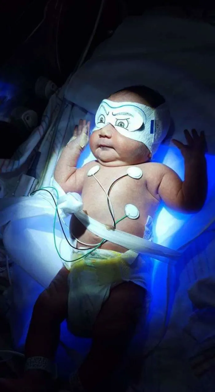 Mi hijo recién nacido tiene ictericia y está recibiendo terapia con luz. Así que le hice esto para los ojos
