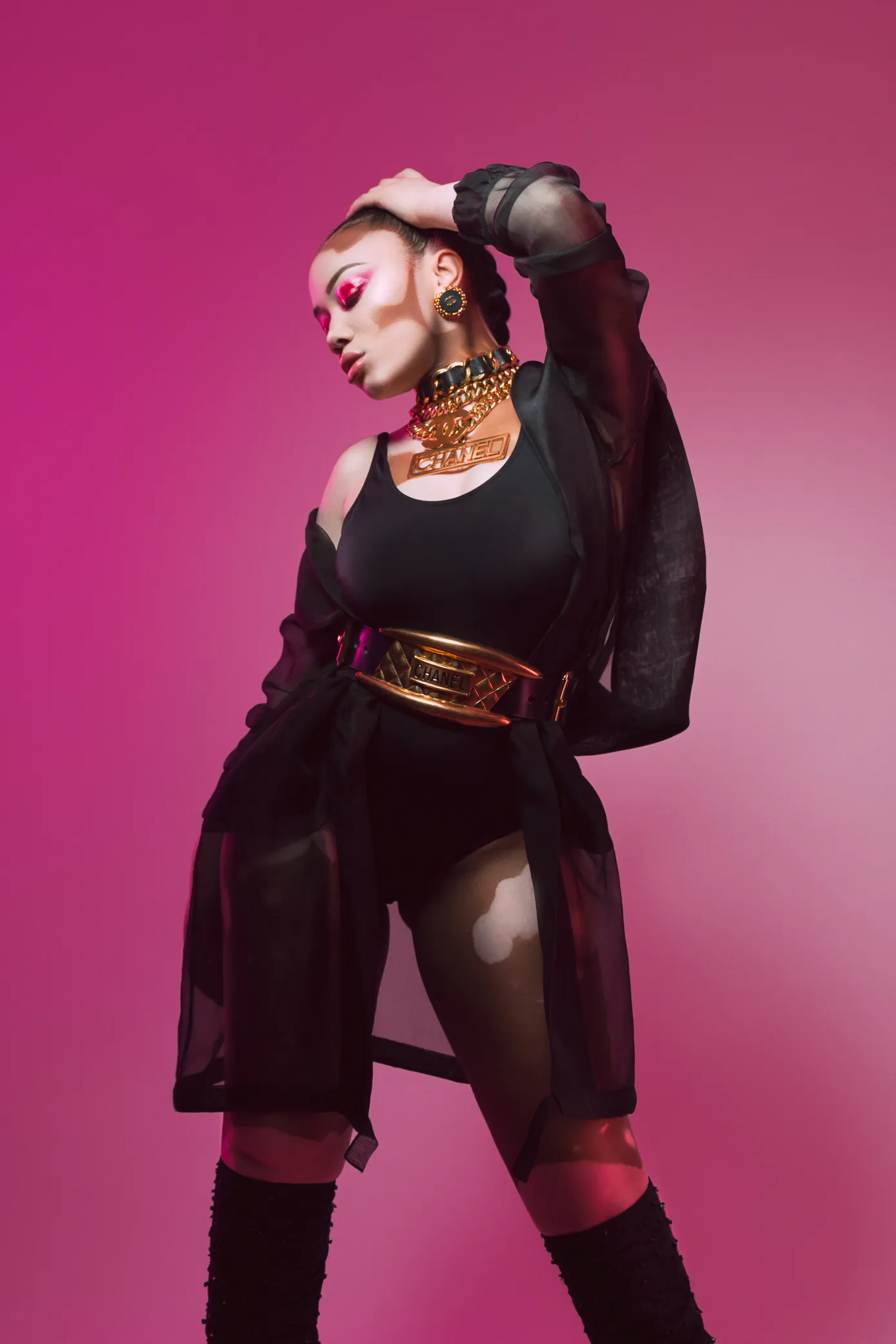 I Did A Photoshoot To Show The Beauty Of Vitiligo