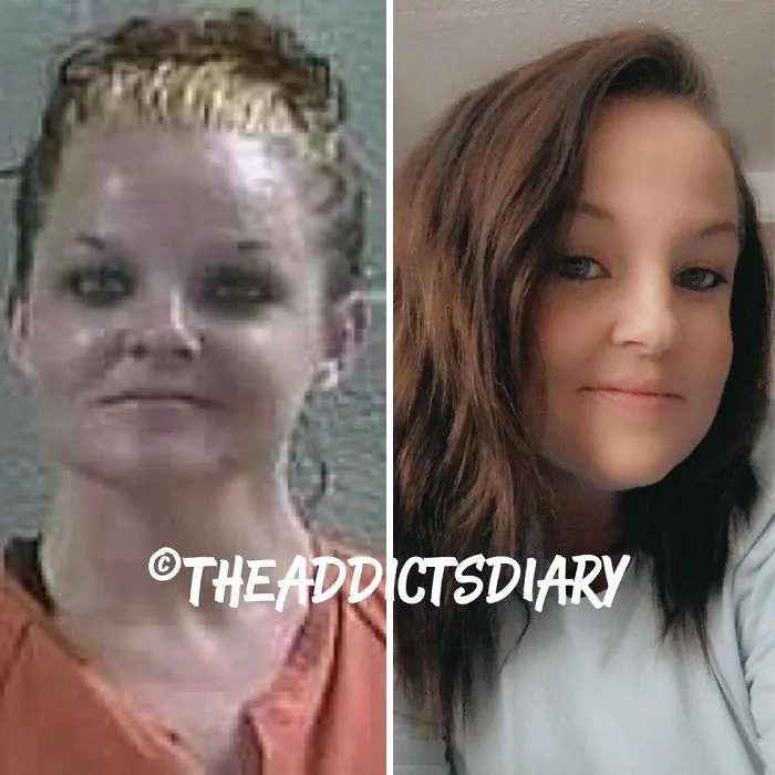 ‘The Addict’s Diary’ Showcases Before & After Transformations Of People Who Quit Drugs (30 New Stories)