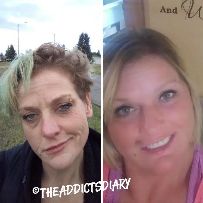 ‘The Addict’s Diary’ Showcases Before & After Transformations Of People Who Quit Drugs (30 New Stories)