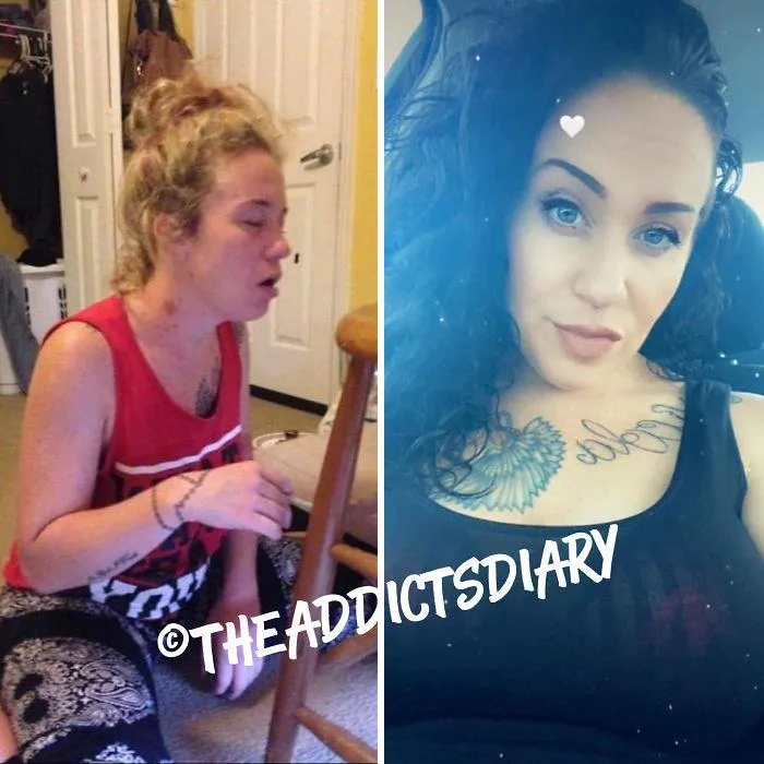 ‘The Addict’s Diary’ Showcases Before & After Transformations Of People Who Quit Drugs (30 New Stories)
