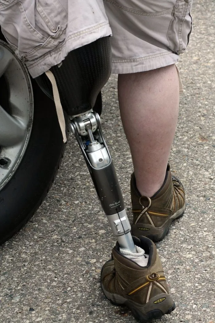 A Missing Leg