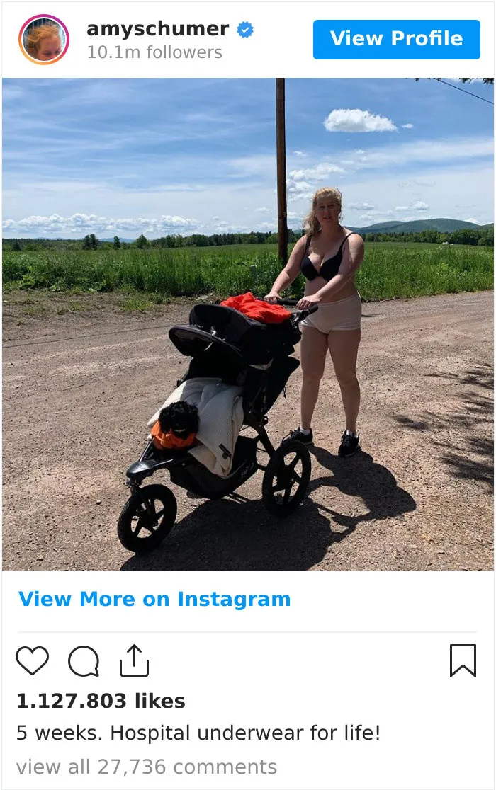 Amy Schumer