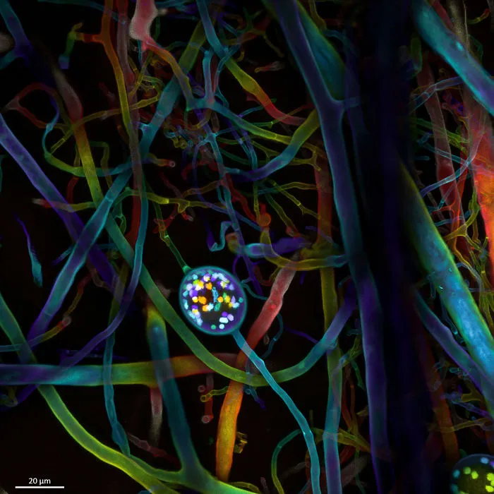 Multi-nucleate spores and hyphae of a soil fungus