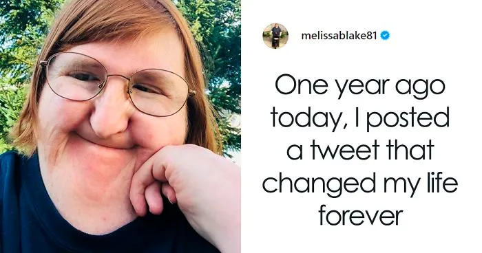 Trolls Tell Woman She's 'Too Ugly' To Be Posting Pics Of Her Face, She Responds By Posting Selfies For A Year
