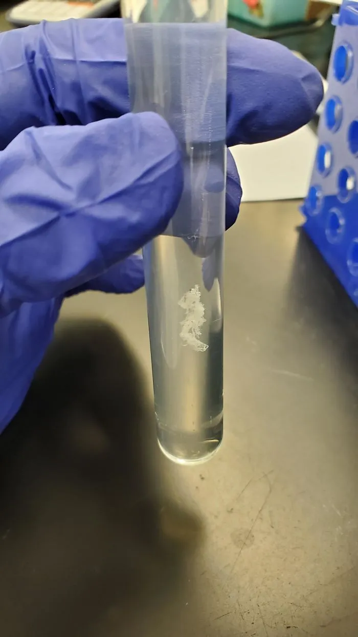 In Case You Have Not Seen What A Clump Of Dna Looks Like
