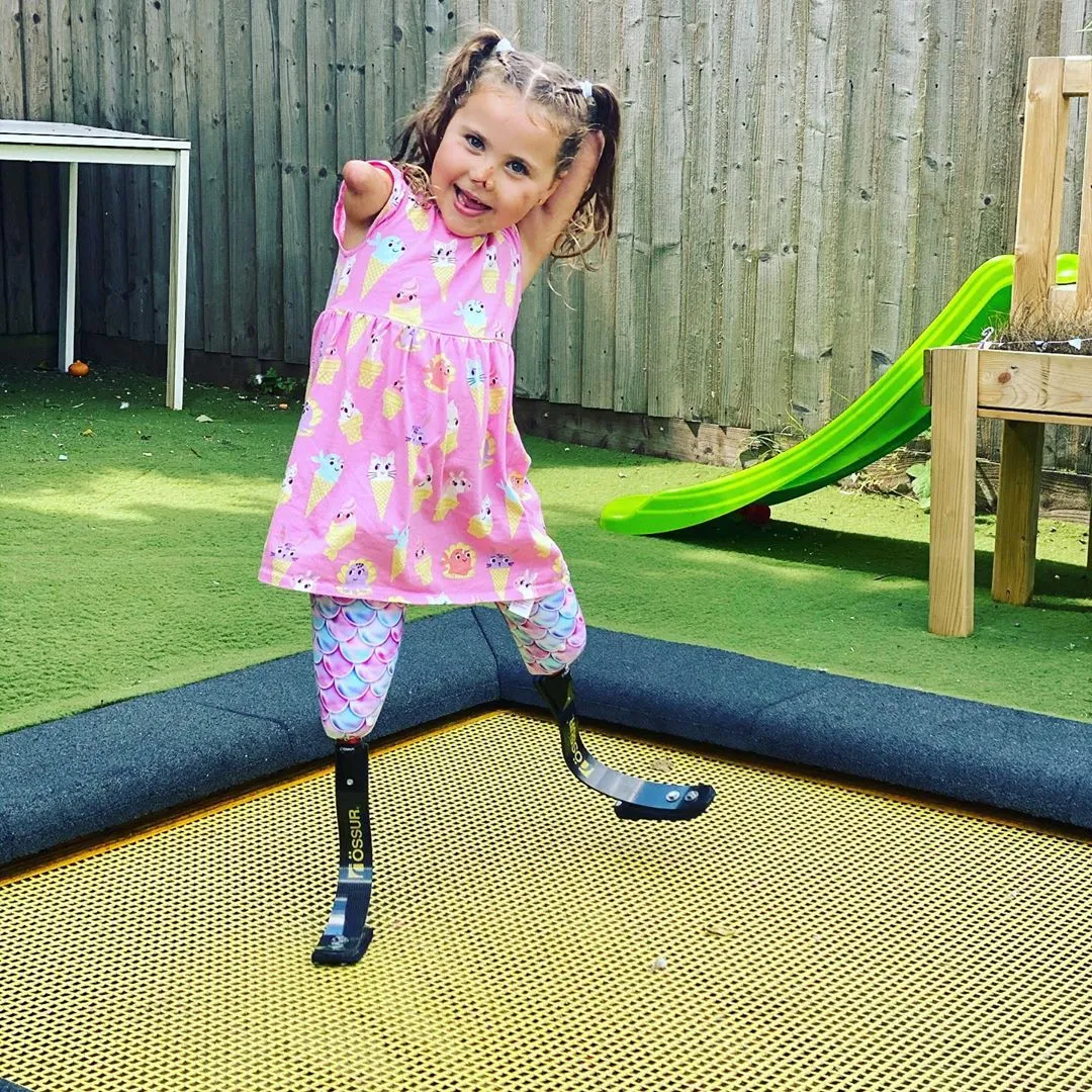 Harmonie The Disable Girl On Doing Gymnastics