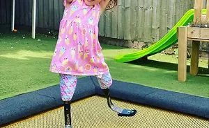 Harmonie The Disable Girl On Doing Gymnastics