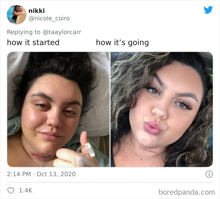 Before and after photos of a woman sharing her inspiring cancer story as part of the how it started vs how it's going challenge.