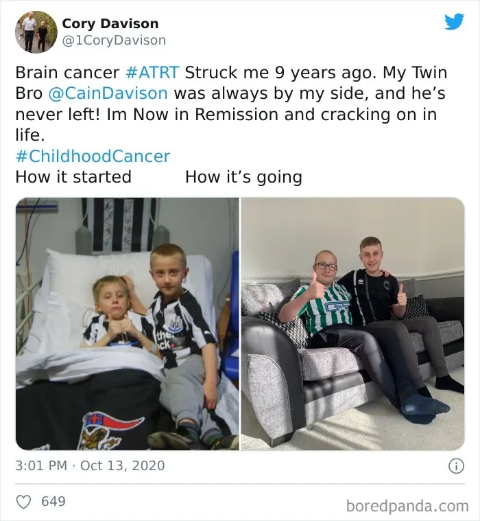 People Take ‘How It Started Vs. How It's Going’ Challenge To Another Level Of Wholesomeness By Sharing Their Cancer Stories (30 Pics)