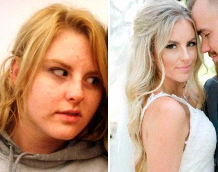 17-24, Went Through Horrible Cystic Acne, Lost 50 Lbs, Got Braces, And Dropped An Emotionally Abusive Boyfriend