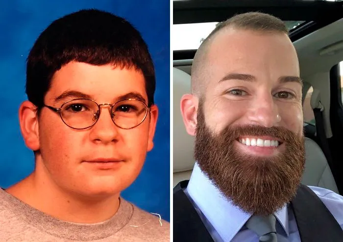 Always Felt So Geeky In High School. I Even Went Through A Period Where I Wanted To End My Life In Middle School Because Of My Weight And Look. Now I’m In My 30’s And Feeling The Most Confident I’ve Been In My Life. Big Thanks For Braces And Lasik