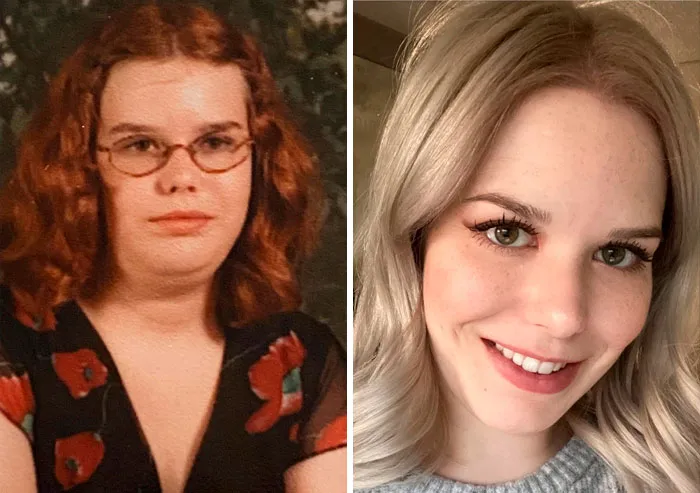 12-27. Perdí una barbilla pero gané una sonrisa