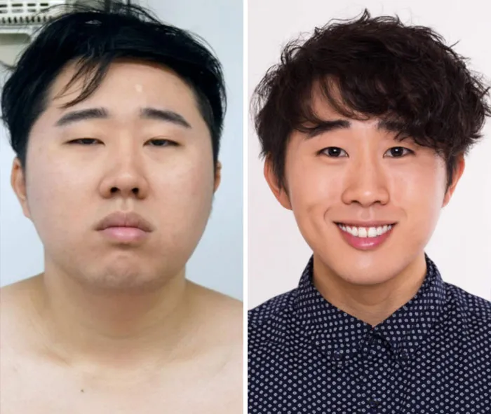 One Year Transformation. 23 To 23 (Almost 24 Hahaha). What A Gym Membership, Self Love And A Skincare Routine Can Do For You