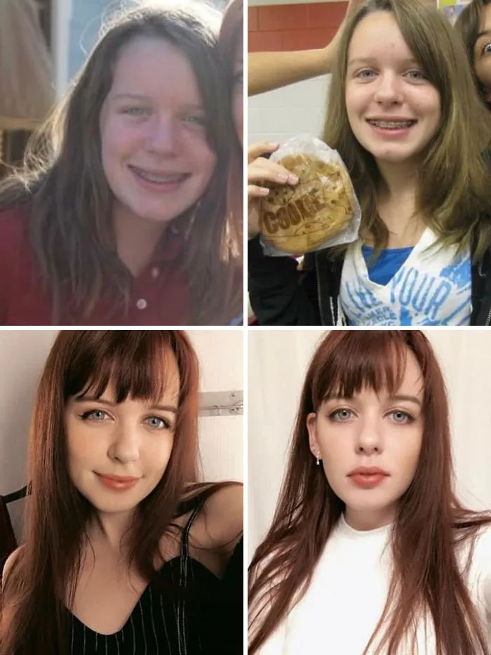 12 vs. 20. Had To Stop Riding The Bus+change My Classes In Middle School Because I Was Bullied So Bad For "Being Ugly"