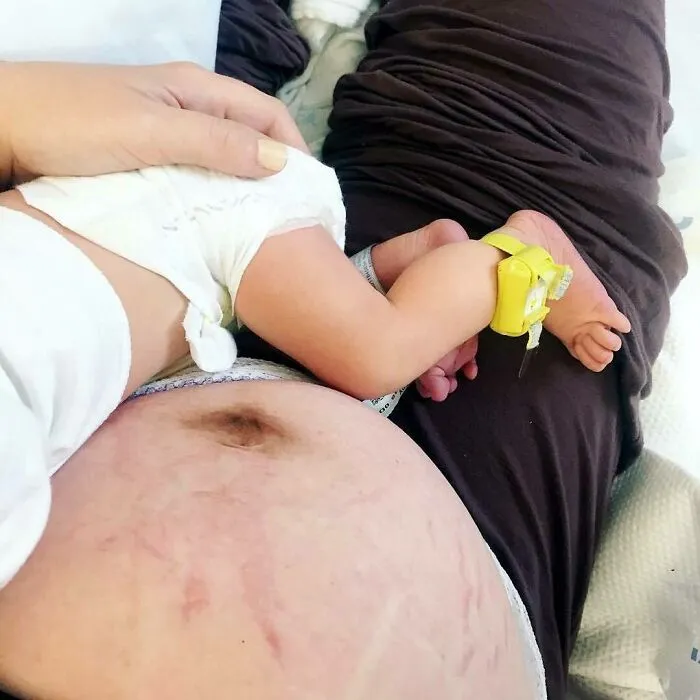 "Nothing But Sheer Amazement, Thinking About How That Little Body Fit Inside This Stomach, Just Two Days Ago"